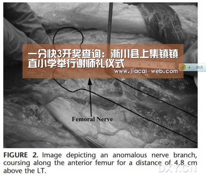 一分快3走势分析